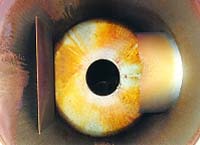 Corrosion of a Vacuum Condenser Vessel