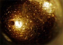 Corrosion of a Rotary Spray Ball